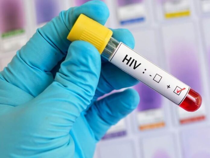 HIV